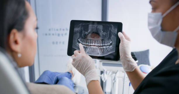 Licensed Dental Implants service in Fresno, TX - Smile Center Dentistry